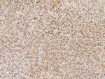 PMVK Antibody in Immunohistochemistry (Paraffin) (IHC (P))