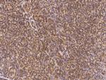 PMVK Antibody in Immunohistochemistry (Paraffin) (IHC (P))