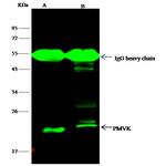 PMVK Antibody in Immunoprecipitation (IP)