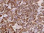 REG1B Antibody in Immunohistochemistry (Paraffin) (IHC (P))