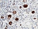 REG3A Antibody in Immunohistochemistry (Paraffin) (IHC (P))