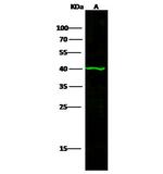 p53R2 Antibody in Western Blot (WB)