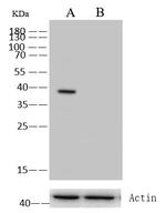 p53R2 Antibody in Western Blot (WB)