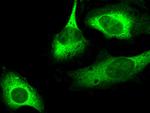 p53R2 Antibody in Immunocytochemistry (ICC/IF)