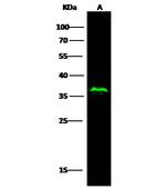 p53R2 Antibody in Western Blot (WB)