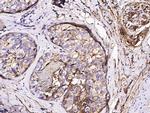 S100A10 Antibody in Immunohistochemistry (Paraffin) (IHC (P))