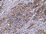 S100A10 Antibody in Immunohistochemistry (Paraffin) (IHC (P))