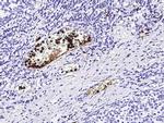 S100A12 Antibody in Immunohistochemistry (Paraffin) (IHC (P))