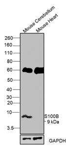 S100B Antibody in Western Blot (WB)