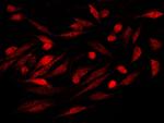 S100P Antibody in Immunocytochemistry (ICC/IF)