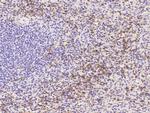 CD162 Antibody in Immunohistochemistry (Paraffin) (IHC (P))