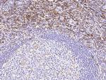 CD162 Antibody in Immunohistochemistry (Paraffin) (IHC (P))