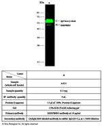 SERPINB3 Antibody in Immunoprecipitation (IP)