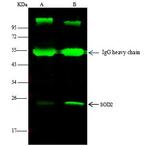 SOD2 Antibody in Immunoprecipitation (IP)