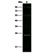 SOD2 Antibody in Western Blot (WB)