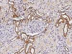 ST6GAL1 Antibody in Immunohistochemistry (Paraffin) (IHC (P))