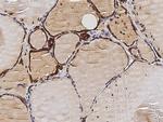 Thyroid Peroxidase Antibody in Immunohistochemistry (Paraffin) (IHC (P))