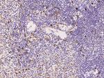 TNFAIP8 Antibody in Immunohistochemistry (Paraffin) (IHC (P))