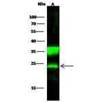 PGP9.5 Antibody in Western Blot (WB)