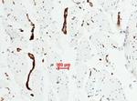 VWF Antibody in Immunohistochemistry (Paraffin) (IHC (P))