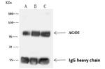 AGO2 Antibody in Immunoprecipitation (IP)