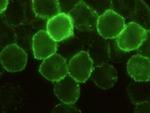 CD6 Antibody in Immunocytochemistry (ICC/IF)