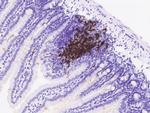 CD79b Antibody in Immunohistochemistry (Paraffin) (IHC (P))