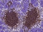 CD79b Antibody in Immunohistochemistry (Paraffin) (IHC (P))