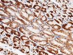 CAR Antibody in Immunohistochemistry (Paraffin) (IHC (P))