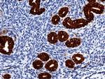 EpCAM Antibody in Immunohistochemistry (Paraffin) (IHC (P))