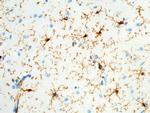 CD64 Antibody in Immunohistochemistry (Paraffin) (IHC (P))