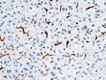 CD64 Antibody in Immunohistochemistry (Paraffin) (IHC (P))