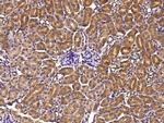 Growth Hormone Receptor Antibody in Immunohistochemistry (Paraffin) (IHC (P))