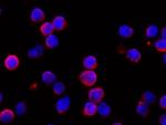 IFNAR1 Antibody in Immunocytochemistry (ICC/IF)