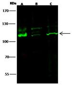 c-Kit Antibody in Western Blot (WB)