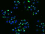 LDLR Antibody in Immunocytochemistry (ICC/IF)