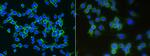 LDLR Antibody in Immunocytochemistry (ICC/IF)