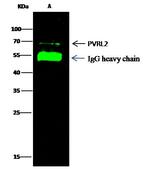 Nectin 2 Antibody in Immunoprecipitation (IP)