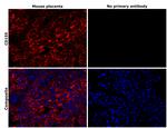 CD155 Antibody in Immunohistochemistry (Paraffin) (IHC (P))