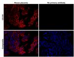 CD155 Antibody in Immunohistochemistry (Paraffin) (IHC (P))