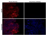 CD155 Antibody in Immunohistochemistry (Paraffin) (IHC (P))