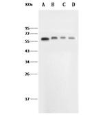 E-selectin Antibody in Western Blot (WB)