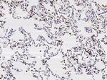 SFTPD Antibody in Immunohistochemistry (Paraffin) (IHC (P))