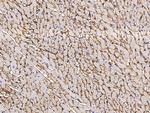 CD36 Antibody in Immunohistochemistry (Paraffin) (IHC (P))