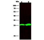 PGP9.5 Antibody in Western Blot (WB)