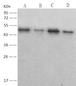 SARS/SARS-CoV-2 Nucleocapsid Antibody in Western Blot (WB)