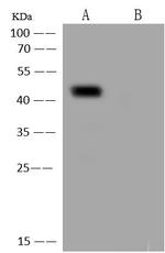 SARS/SARS-CoV-2 Nucleocapsid Antibody in Western Blot (WB)