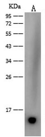 Dengue Virus Type 2 Envelope (Domain III) (strain New Guinea C/PUO-218 hybrid) Antibody in Western Blot (WB)