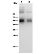 Zika Virus NS1 (strain Zika SPH2015) Antibody in Western Blot (WB)