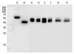 RSV Fusion Protein Antibody in Western Blot (WB)
